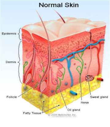 What causes stretch marks