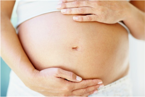 stretch marks pregnancy